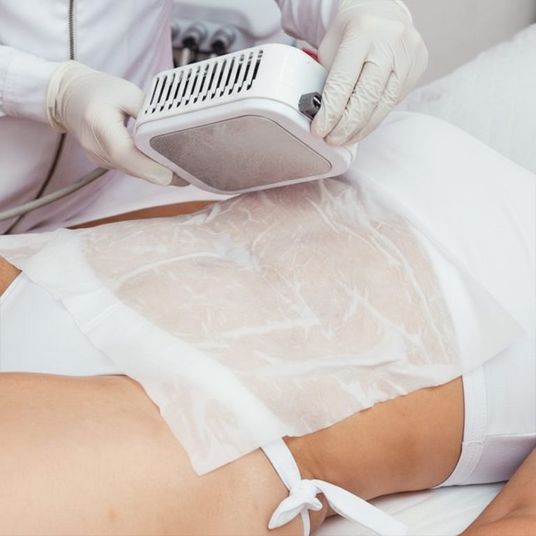 09-Laser-Lipo-(Large-Area-with-Transfer)