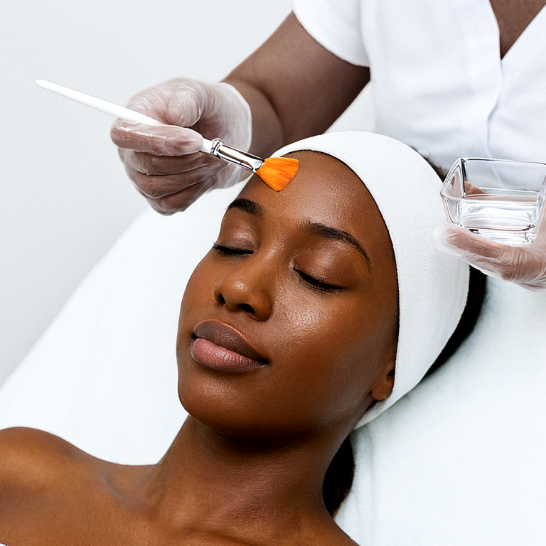 18 Derma Peel