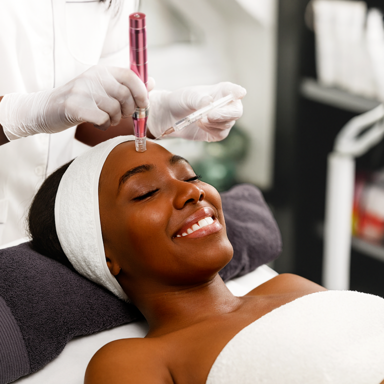 22 Microneedling with PRP